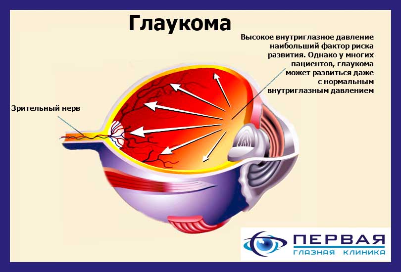 Лечение глаукомы глазная клиника 1.jpg